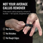 SandBar 4" Quickie Callus Kit