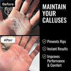 SandBar 4" Quickie Callus Kit